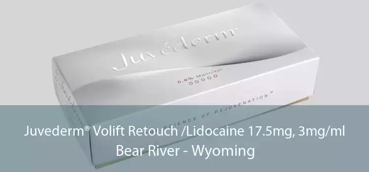 Juvederm® Volift Retouch /Lidocaine 17.5mg, 3mg/ml Bear River - Wyoming
