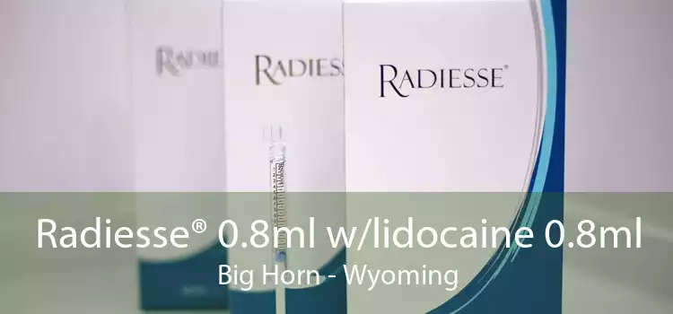 Radiesse® 0.8ml w/lidocaine 0.8ml Big Horn - Wyoming